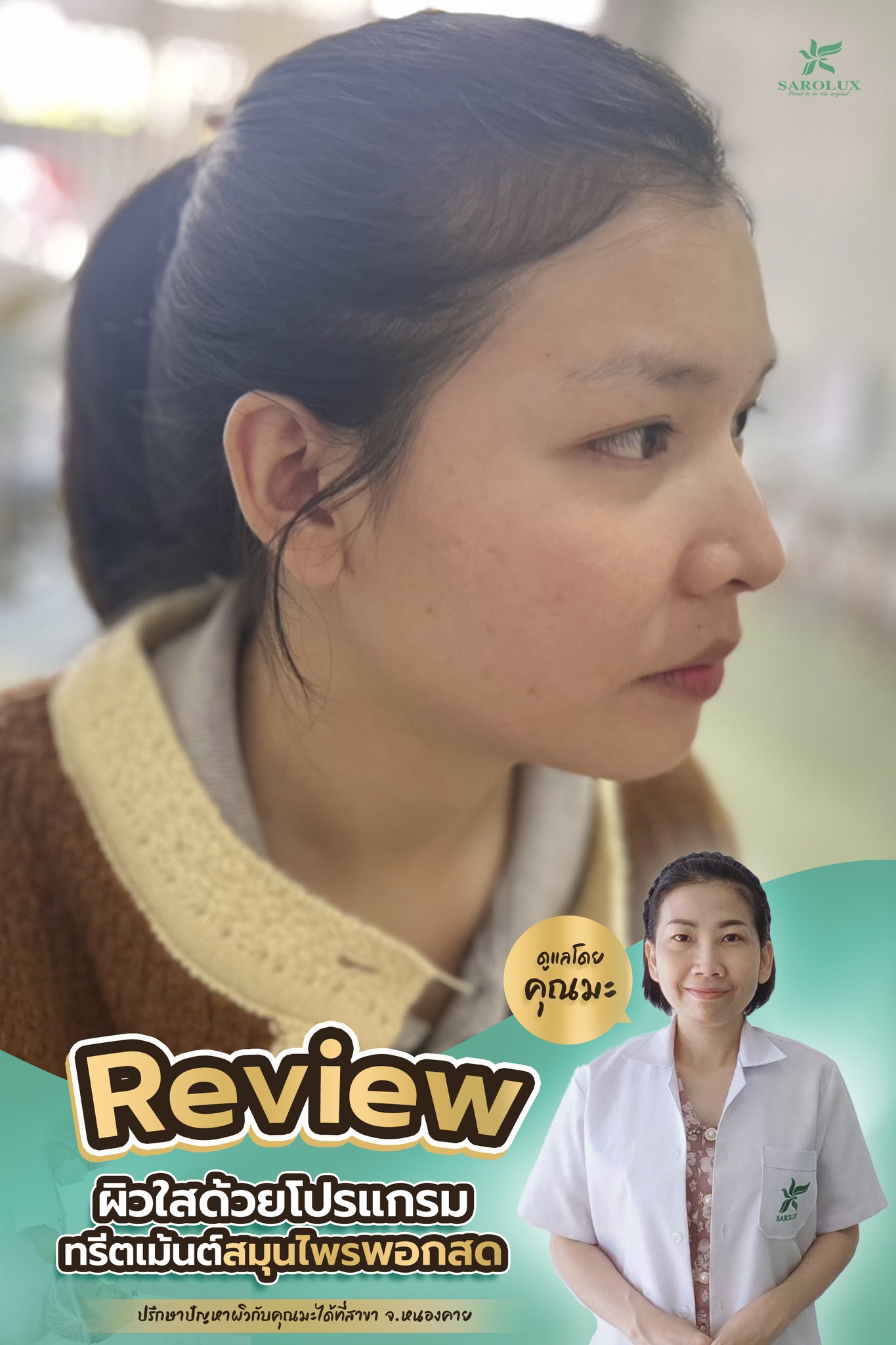 Review ลูกค้าผิวใสด้วยทรีตเมนท์สมุนไพรพอกสด