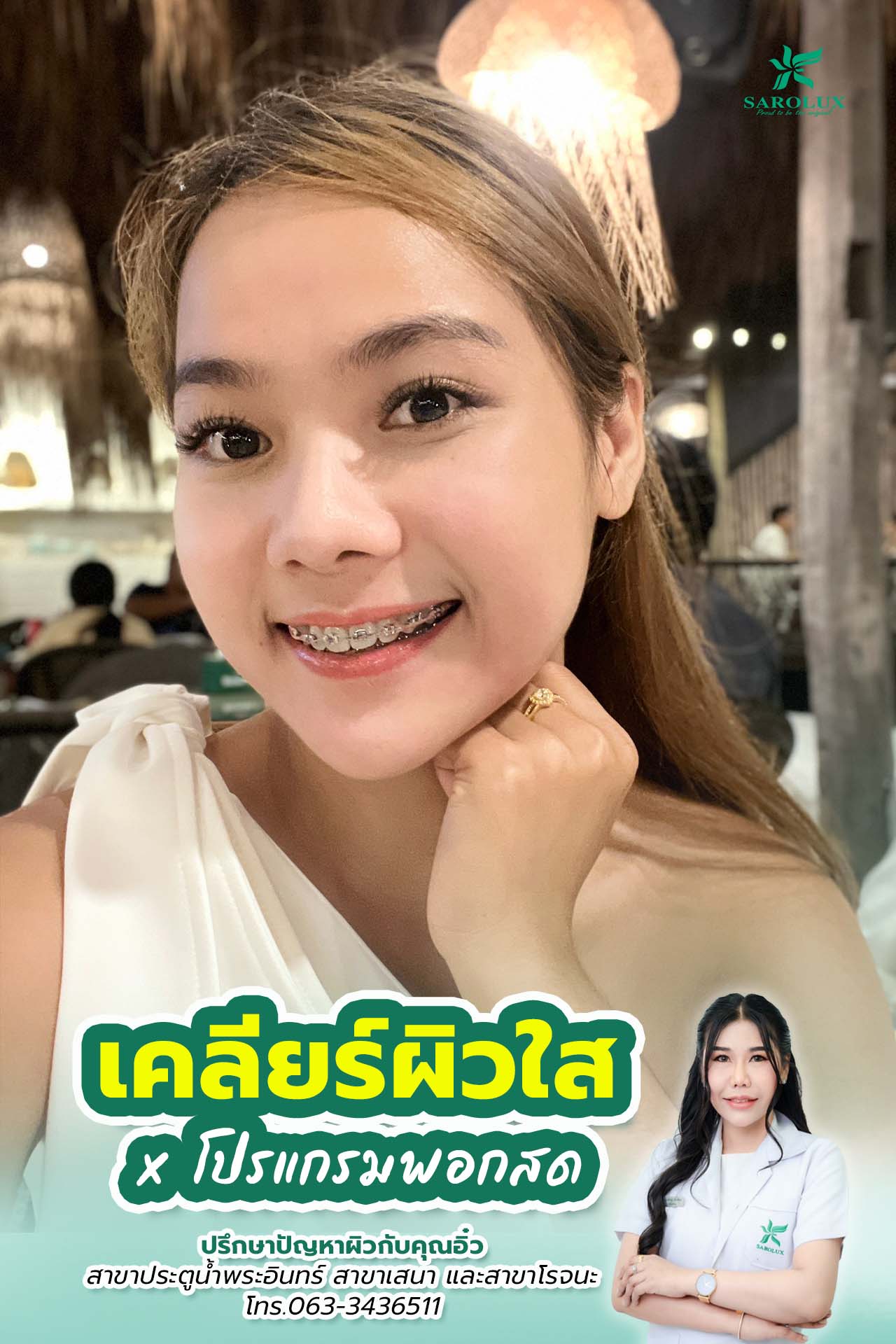 เคลียร์ผิวใส โปรแกรมพอกสด กับคุณอิ๋ว