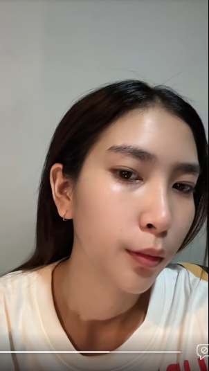 ผิวลอก แดง แสบง่าย... แตะอะไรก็แพ้ด้วย Ceramide