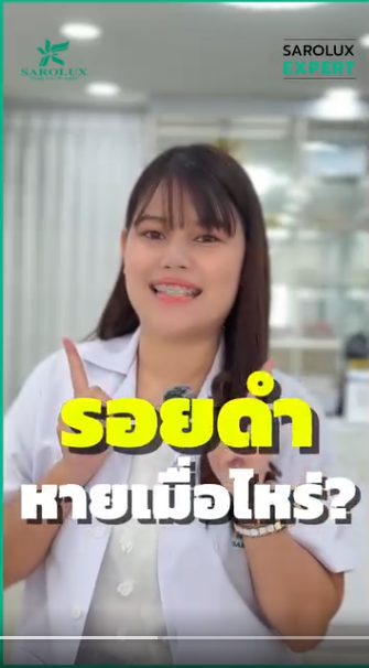 รอยดำหายเมื่อไหร่?