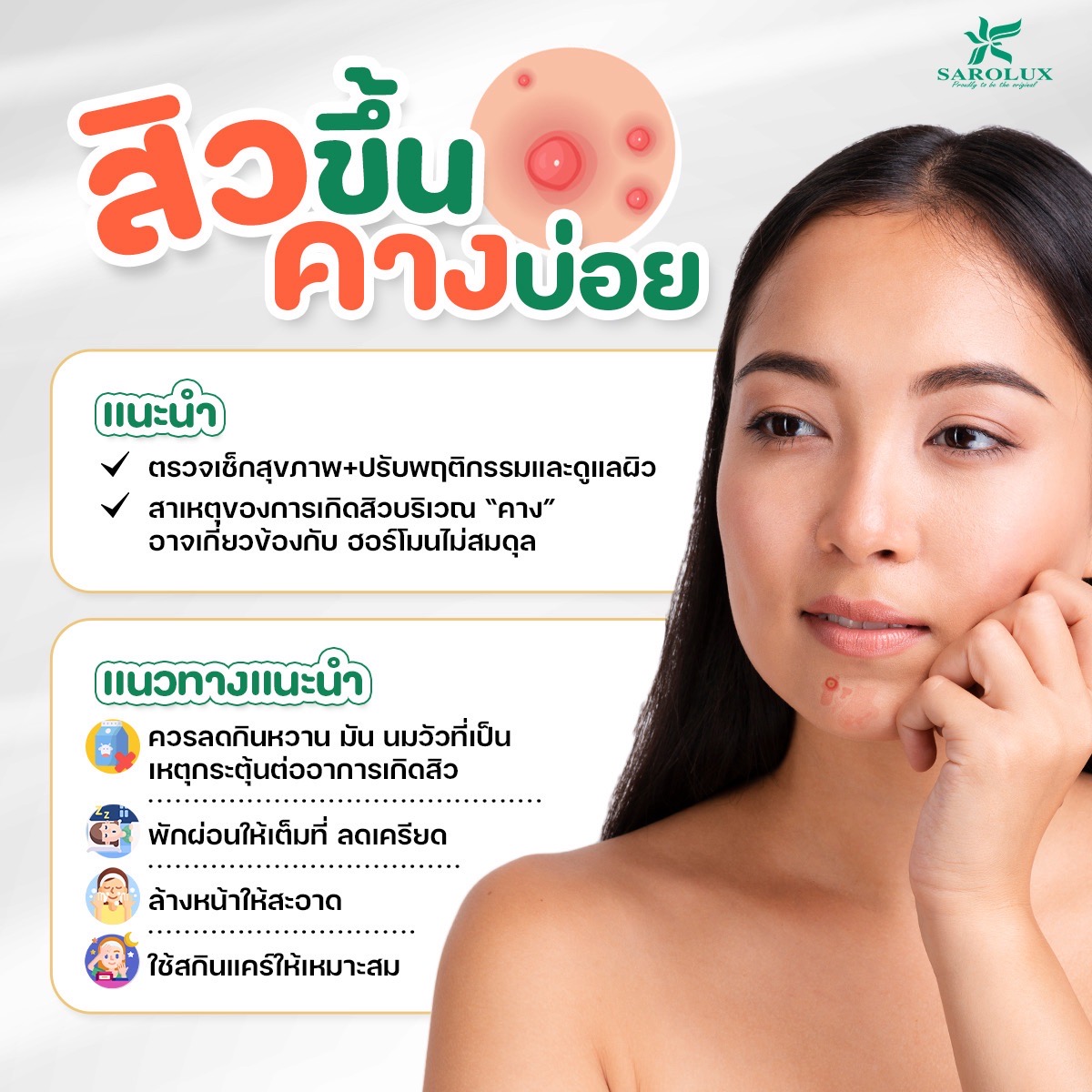 สิวขึ้นคางบ่อย
