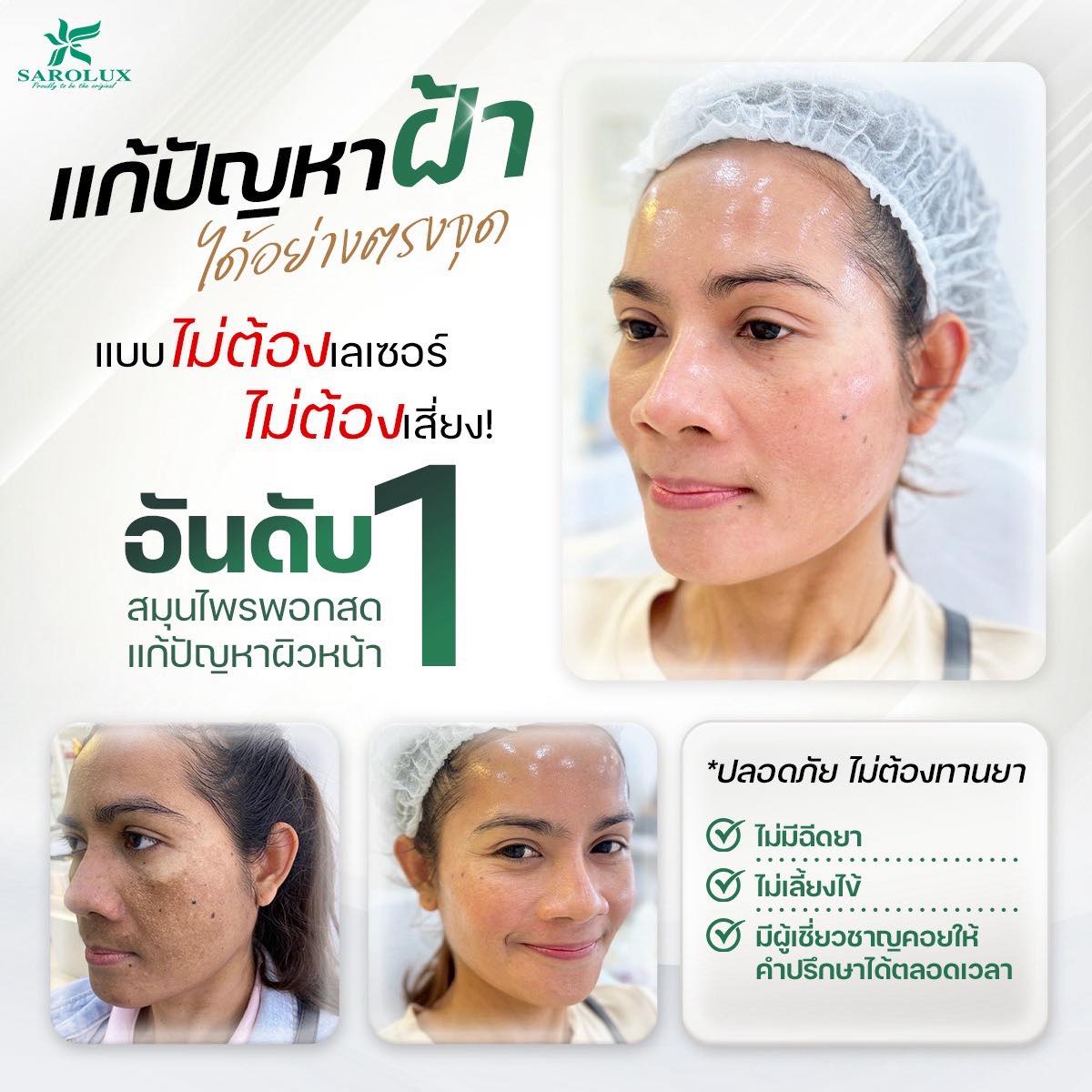 แก้ไขปัญหาฝ้าได้อย่างตรงจุด
