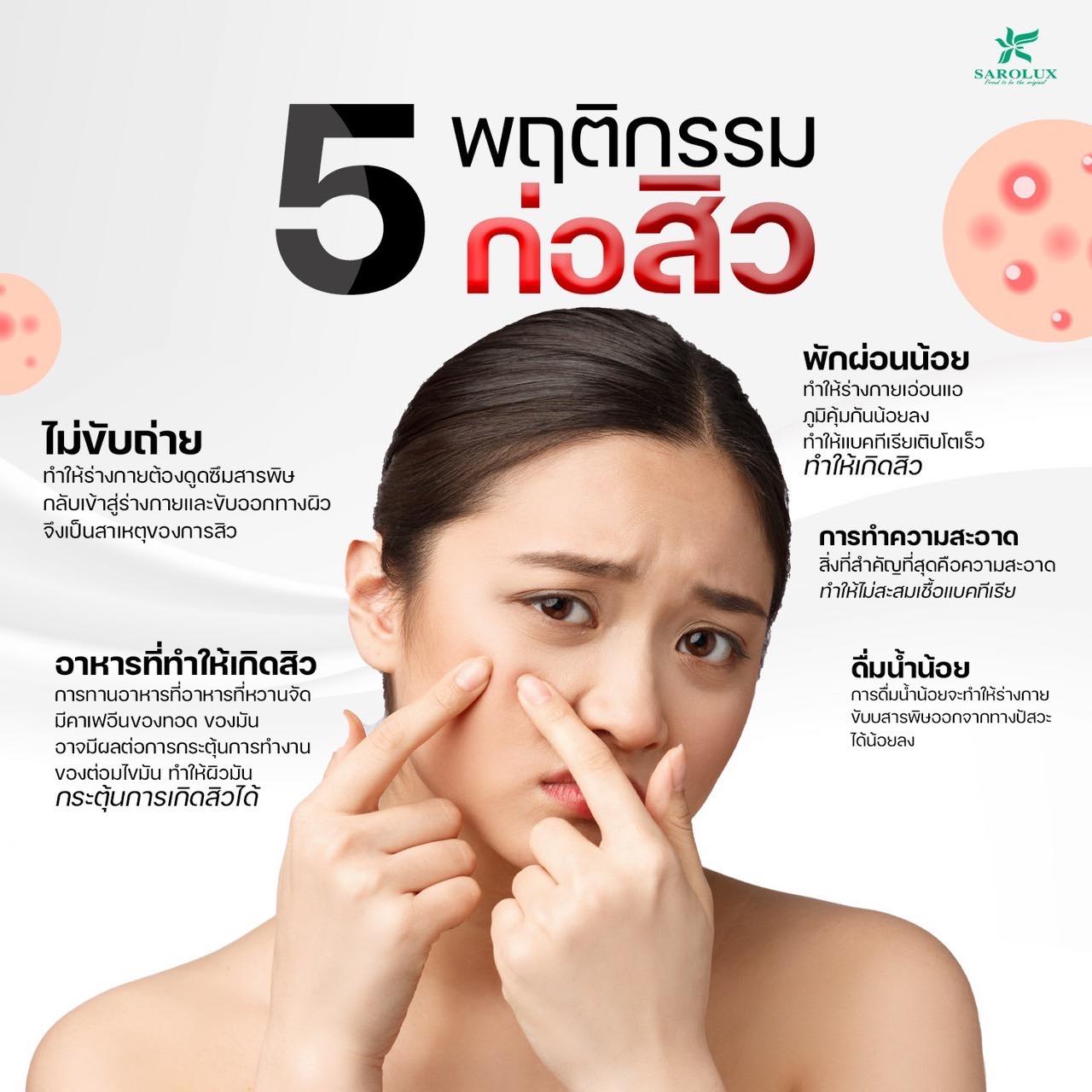5 พฤติกรรมก่อสิว