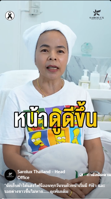 ริวิวลูกค้ามีฝ้าผิวหน้าเยอะมาก