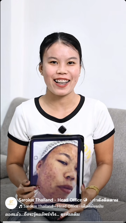 ลูกค้ามาแชร์ประสบการณ์แก้ไขปัญหาผิวหน้าลูกค้าได้หายจริงแน่นนอน