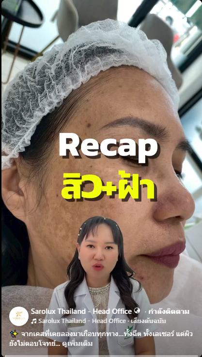 จากเคสที่เคยลองมาเกือบทุกทาง&hellip;ทั้งฉีด ทั้งเลเซอร์ แต่ผิวยังไม่ตอบโจทย์