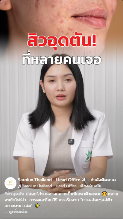 สิวอุดตัน