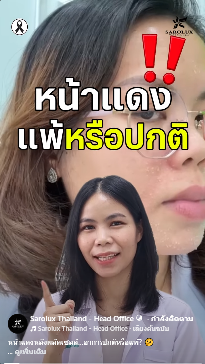 หน้าแดงหลังผลัดเซลล์&hellip;อาการปกติหรือแพ้